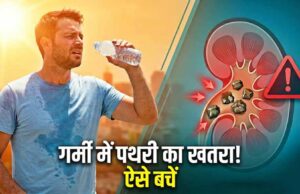 गर्मी में बढ़ा किडनी स्टोन का खतरा, डिहाइड्रेशन बन रहा बड़ा कारण