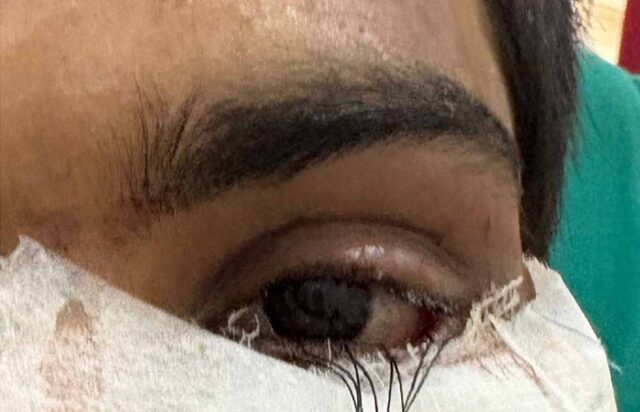 Eye_h.jpg