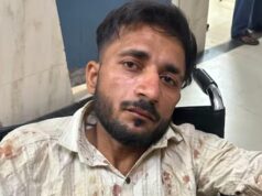 UP पुलिस परीक्षा देने जा रही छात्राओं से छेड़छाड़, आरोपी ऑटो ड्राइवर पुलिस एनकाउंटर में घायल