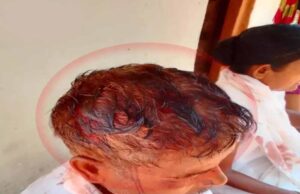 सुकमा में प्रार्थना सभा बनी रणभूमि, दो पक्षों में जमकर मारपीट, कई ग्रामीण घायल