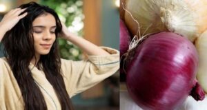 बारिश में तेजी से झड़ रहे बाल? प्याज के रस की ये ट्रिक करें, जड़ों से मजबूत होंगे बाल