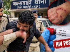 छतरपुर में रेप के आरोपी ने कांस्टेबल को काटा, मेडिकल जांच में HIV पॉजिटिव