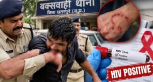 छतरपुर में रेप के आरोपी ने कांस्टेबल को काटा, मेडिकल जांच में HIV पॉजिटिव